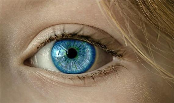 درمان تنبلی چشم با بررسی 2 مسیر جداگانه مغز