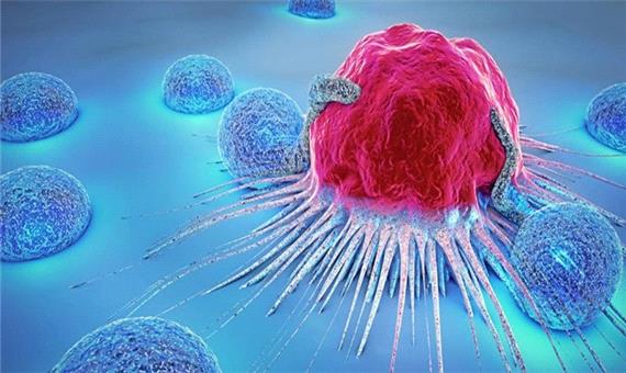 کشفیات تازه در مورد نابودی سلول‌های سرطانی با اسید چرب