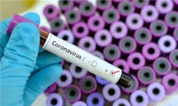 تشخیص ویروس کووید 19 در کمتر از 10 دقیقه